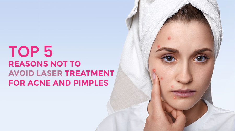 Top 5 reasons not to avoid laser treatment for acne and pimples 