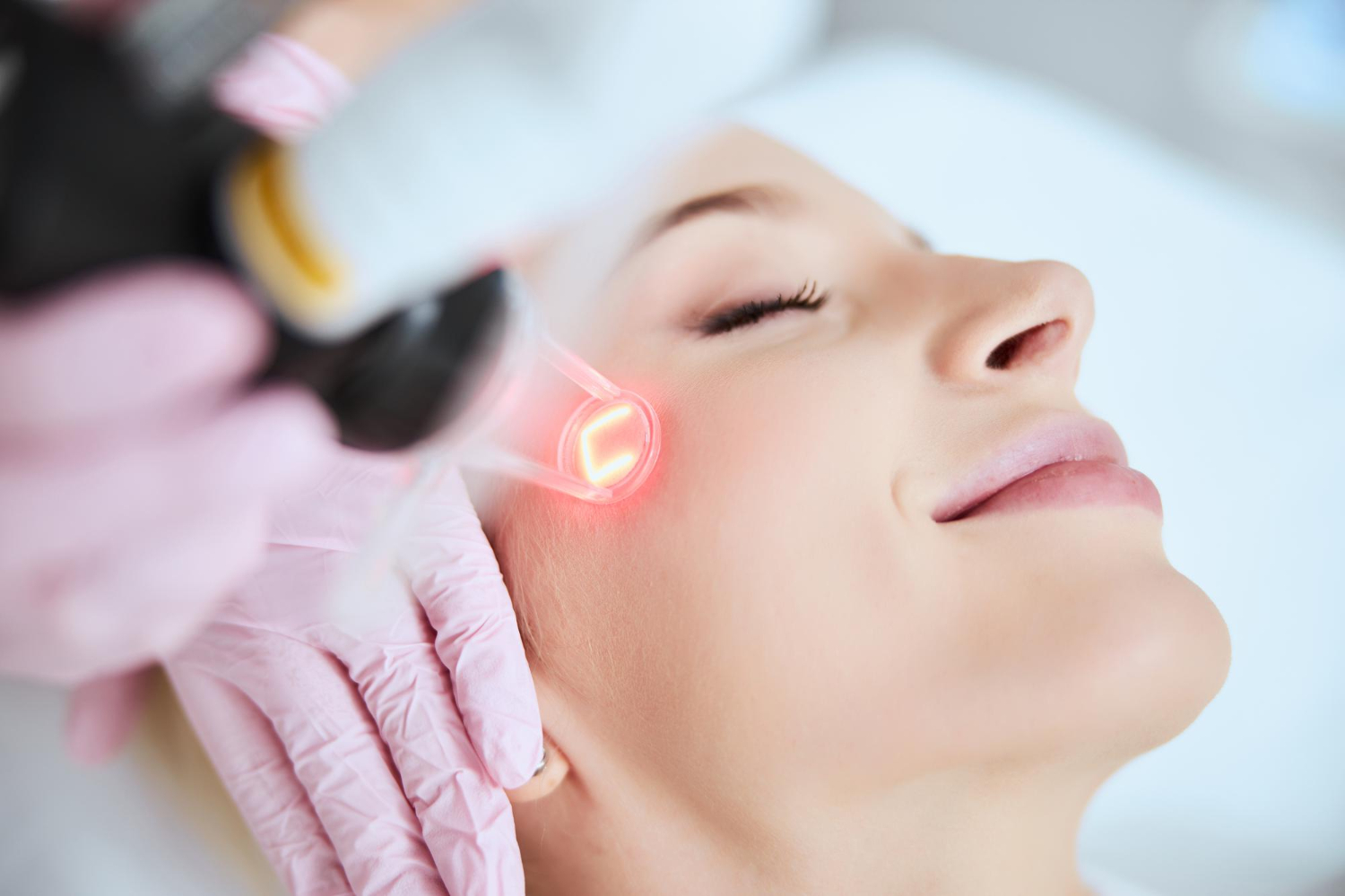 What is the Best Time to Get Skin Laser Treatment?